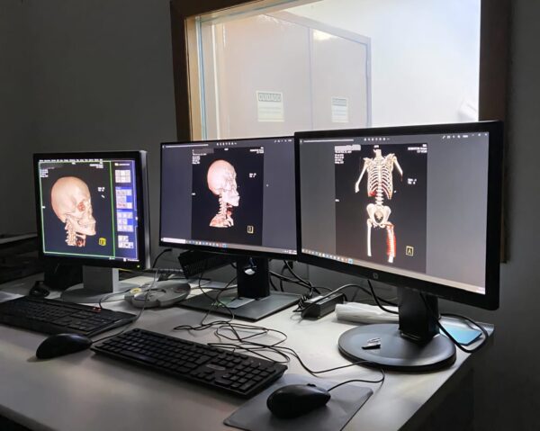 Policiais civis do DF recebem treinamento em radiologia forense